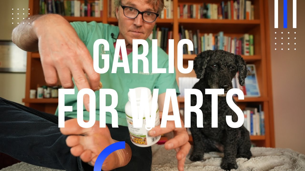 Garlic for Warts Veterinary Secrets with Dr. Andrew Jones, DVM