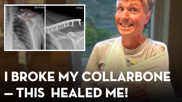 Natural Remedies That Helped Me Heal a Broken Collarbone Quickly